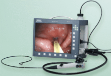 Wie moderne Industrie Endoskope die vorausschauende Wartung revolutionieren 6 moderne Industrie Endoskope